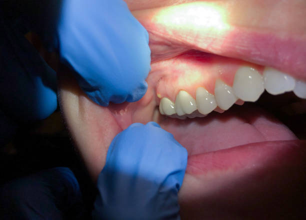 Best Broken Tooth Emergency  in Five Points, OH