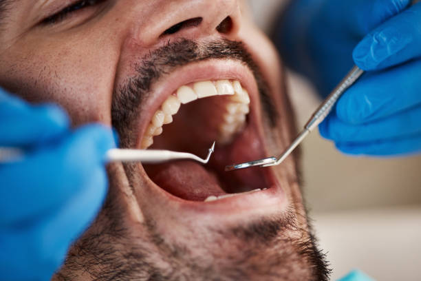 Best Urgent Tooth Repair  in Five Points, OH
